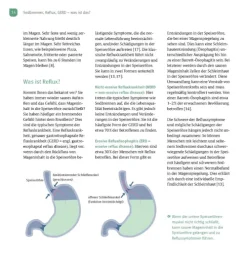 Köstlich essen Reflux und Sodbrennen*Trias