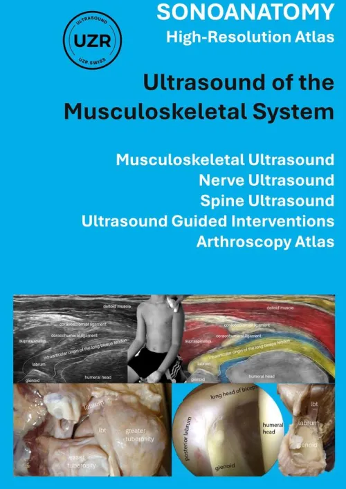 BoD - Books on Demand Sachbücher|Englische Bücher-Sonoanatomy - High-Resolution Atlas - Ultrasound of the Musculoskeletal System